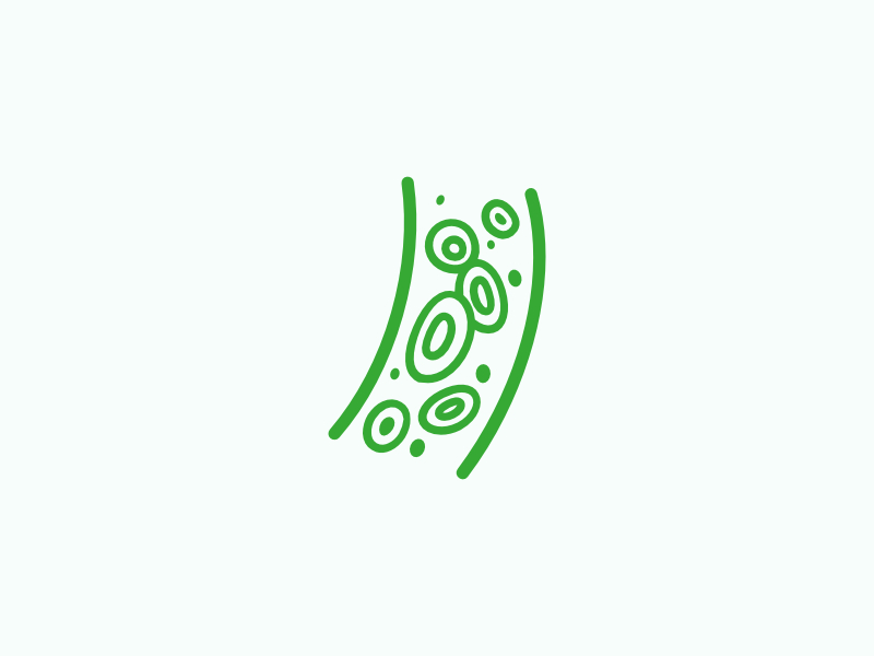 Hematoloogilised kasvajad